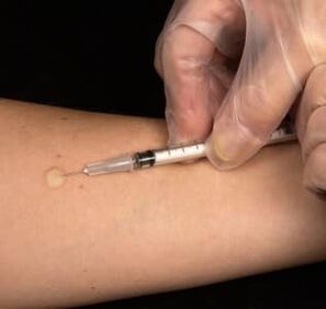 Testosterone subcutaneous injection
